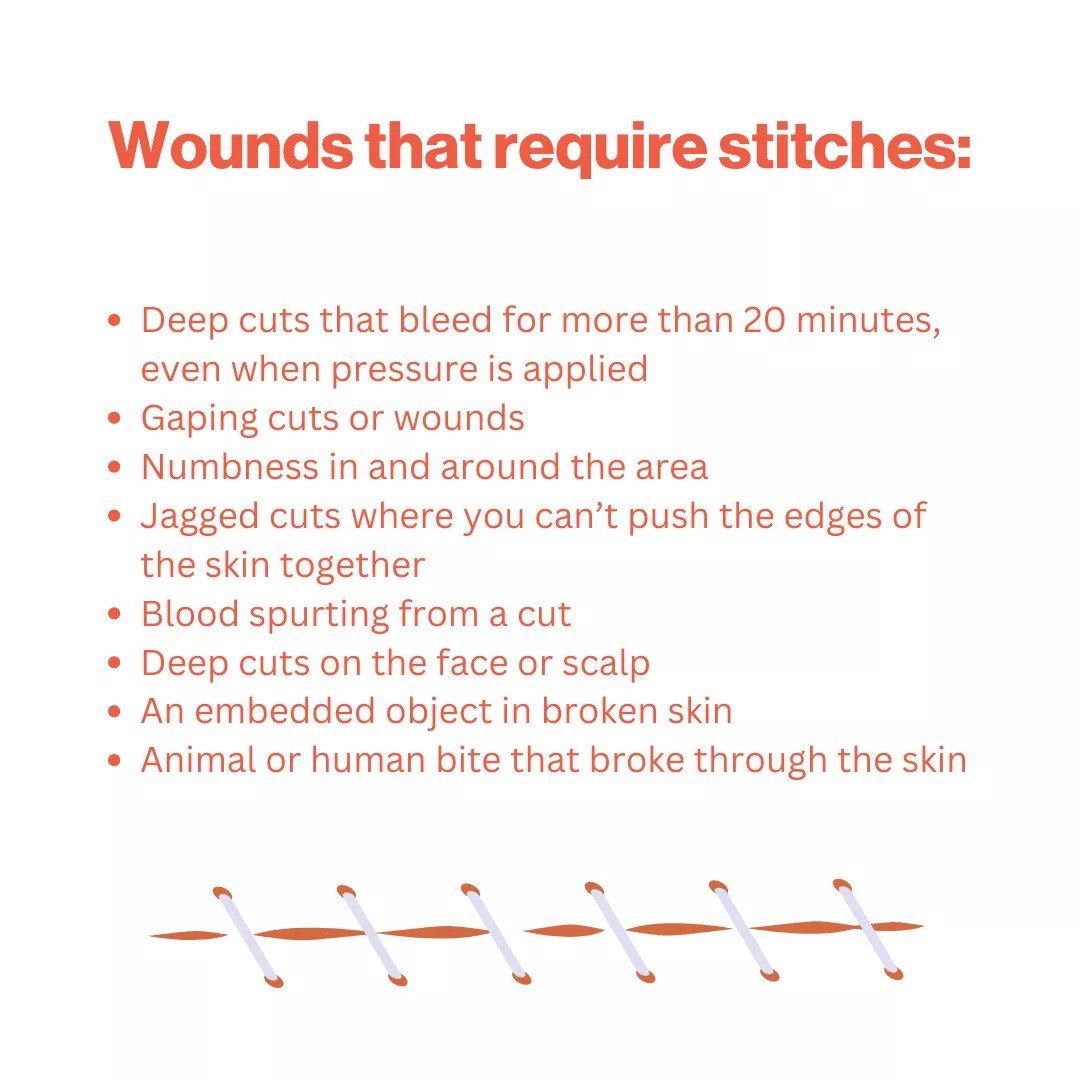Wounds that require stitches