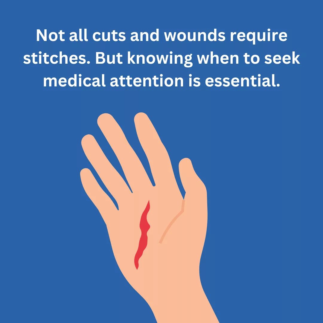 Cuts and lacerations